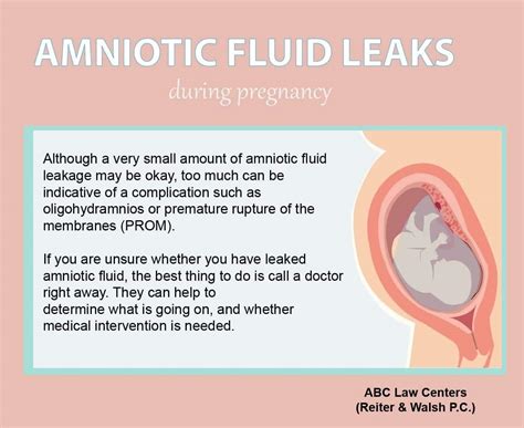 does leaking amniotic fluid smell|Leaking Amniotic Fluid: How to Tell